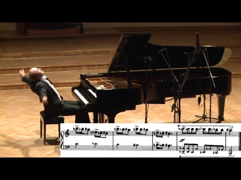 "Doctor, why does my back hurt?"