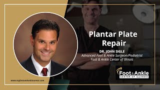 Plantar Plate Repair | Dr. John Sigle | Foot & Ankle Center of Illinois