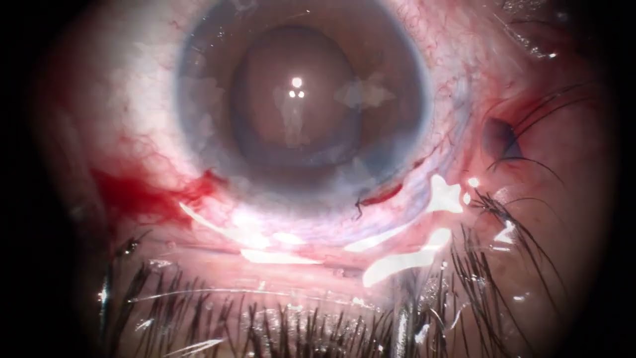 Pablo Alexis Limon Zurita-6