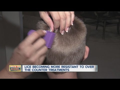 Parent worry about super lice