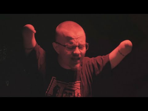 Nubs of Odd Squad Family - "Disconnected"  Feat. Enkay47 (Prod by MarleeyRich)