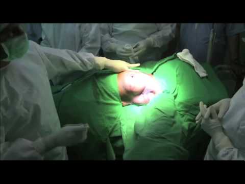 Robotic Cancer Surgery — Innovations