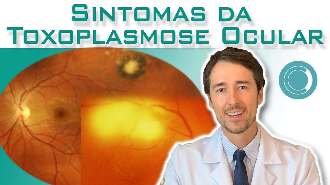 Sintomas da Toxoplasmose Ocular