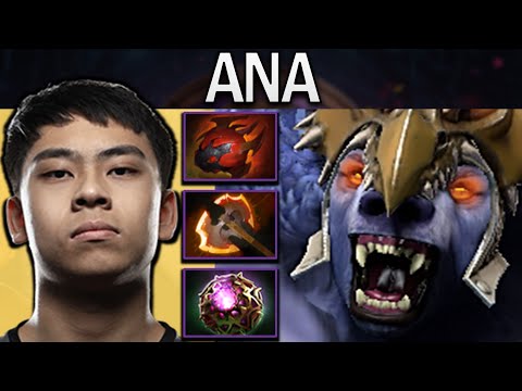 Ursa Dota 2 Gameplay Ana with 20 Kills - Octarine