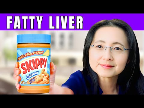 Inflammation Top 10 Ways To Beat Allergies