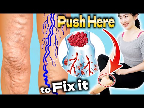 Push Here for 3 Minutes to Remove Swelling & Prevent Varicose Veins and Slim Legs