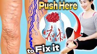 Push Here for 3 Minutes to Remove Swelling & Prevent Varicose Veins and Slim Legs