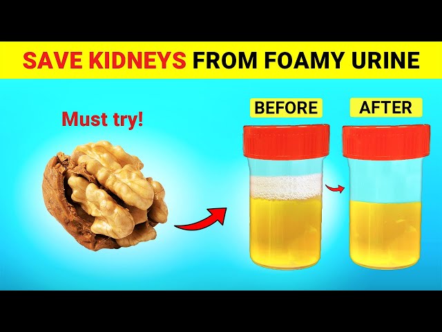 Top 6 Super Foods To Help Stop Proteinuria and Heal Your Kidneys | Magica