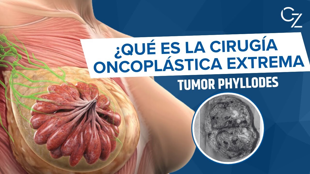 Gonzalo Ziegler Rodriguez-11