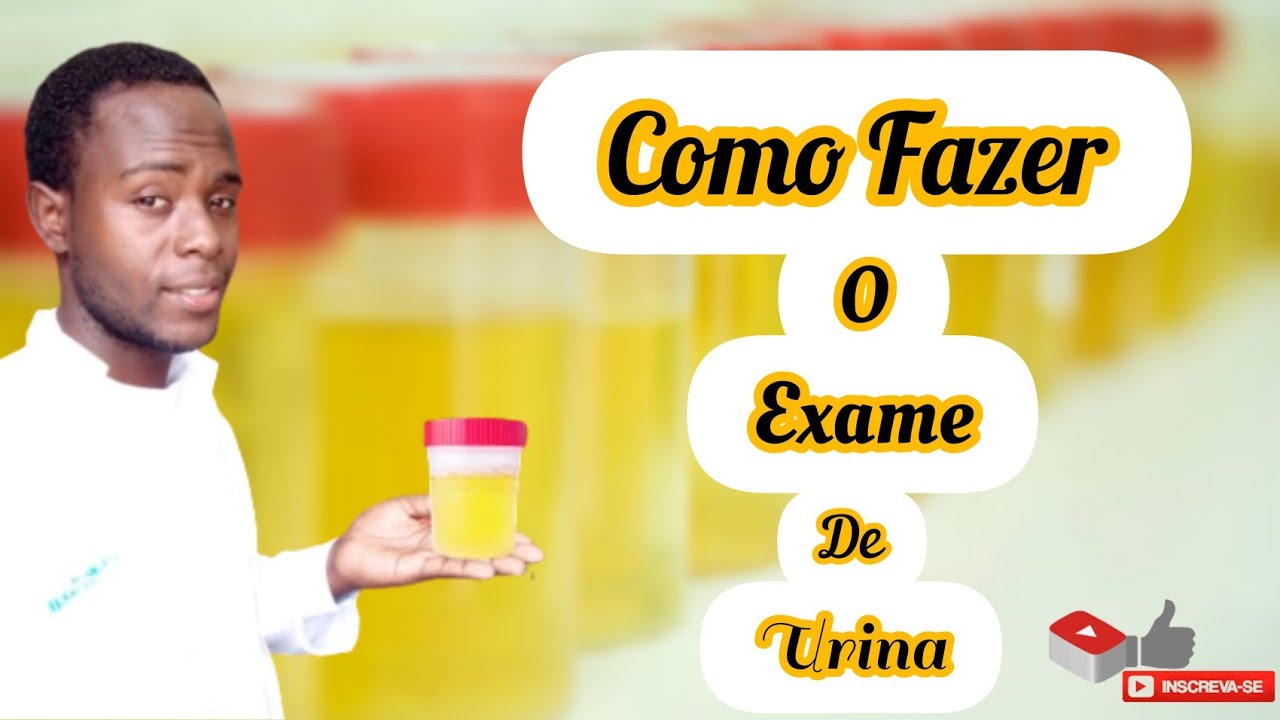 COMO FAZER O EXAME DE URINA ( Exame Fisico, Químico e Microscópico)