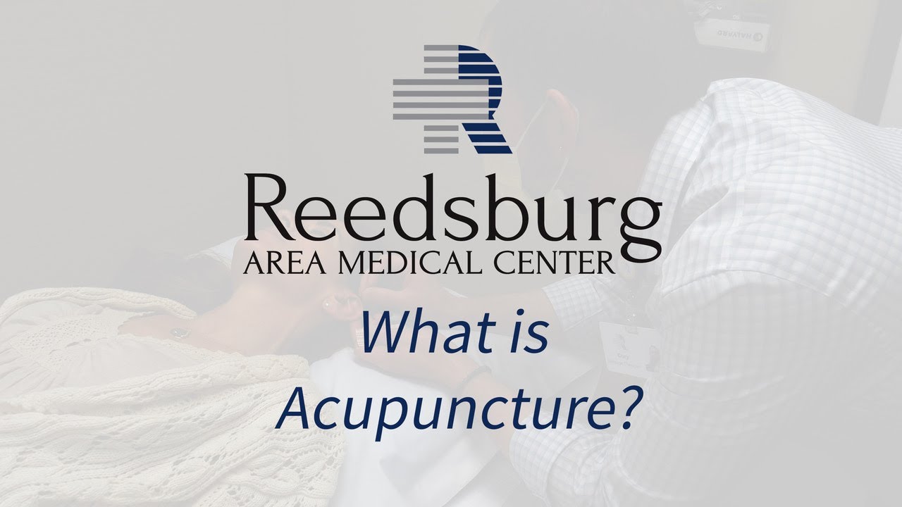 What is Acupuncture?