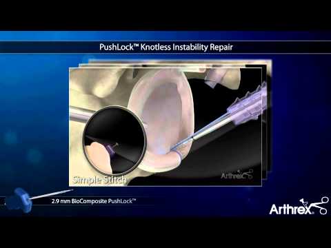 Tratament articular cu portocale