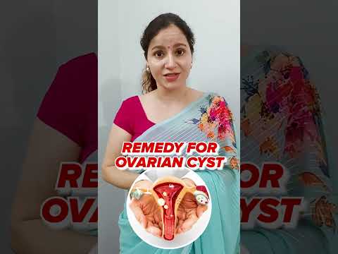 Ovarian Cysts Treatment | Causes Of Ovarian Cysts In Women | How To Cure Ovarian Cyst Naturally