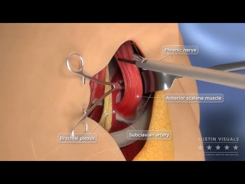 Surgical Explainer Medical Company - Customer Success Story