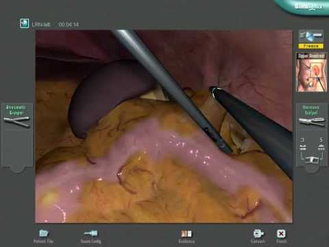 Virtual Reality Laparoscopic Nephrectomy