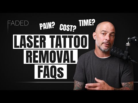 The Most Frequently Asked Questions about Laser Tattoo Removal