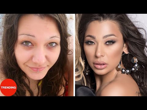 Devojke Iz Hurricane  PRE I POSLE estetskih zahvata