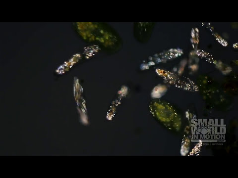 Unicellular Ciliates (Paramecium Caudatum and Frontonia Leucas) | 2015 Nikon Small World