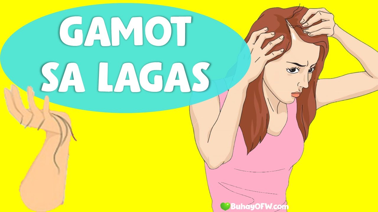 Putar video HALAMANG GAMOT SA PAGLAGAS NG BUHOK: Dahilan bakit nalalagas ang buhok ko Paano ito maagapan sekarang HALAMANG GAMOT SA PAGLAGAS NG BUHOK: Dahilan bakit nalalagas ang buhok ko Paano ito maagapan