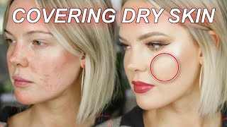EXTREMELY DRY SKIN FOUNDATION ROUTINE *surprising makeup tips for dry and sensitive skin*