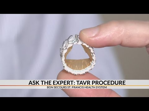 Ask The Expert: Tavr Procedure
