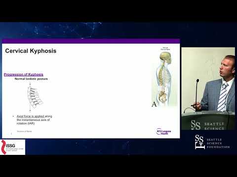 Optimizing Outcomes in Adult Cervical Spine Deformity Surgery - Peter G. Passias, MD, MS