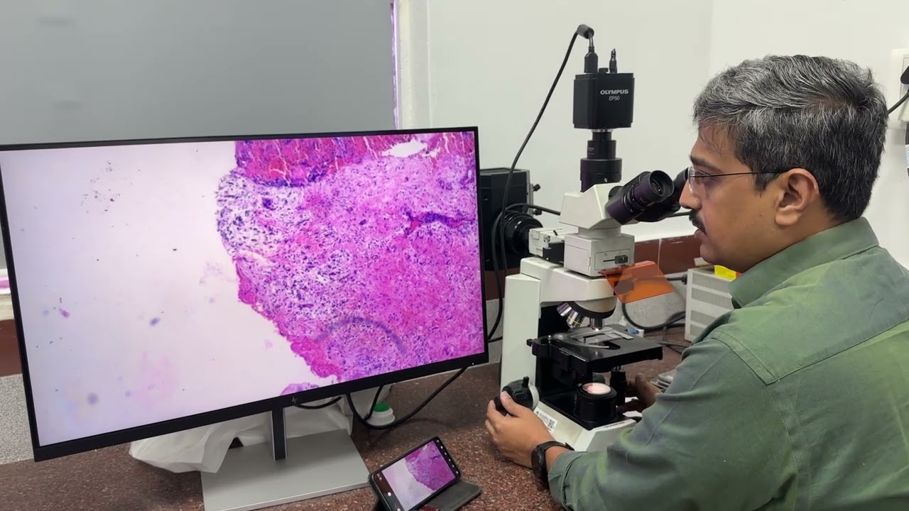 Image J: Processing Images - Subtraction