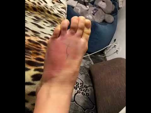 Агата Быковская показала изнанку этого красивого вида спорта.