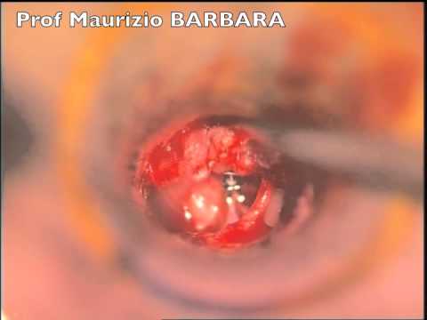 Esercizio dopo il video di esercizi di sostituzione del ginocchio Daria Lisichkina rachide cervicale