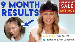 iRestore Elite Helmet Results - Hair Growth After 9 Months + Anniversary Sale!