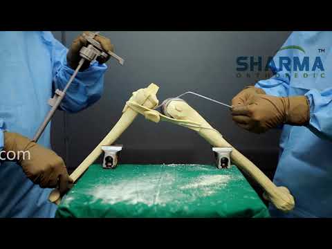Total Knee Replacement- PS (POSTERIOR STABILIZED)- Primary Total Knee Replacement