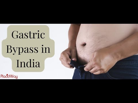 Gastric Bypass in India