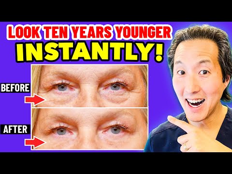 How to Instantly Look 10 Years Younger the Holistic Way!