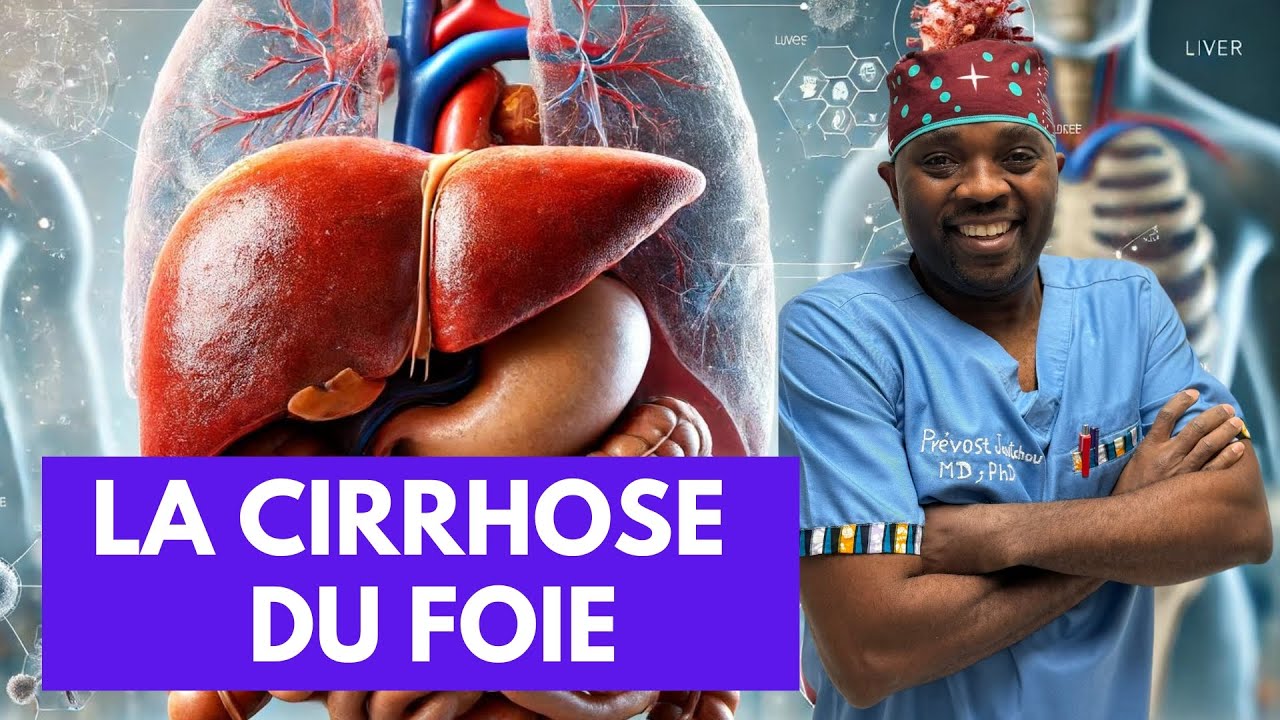 Tout ce que vous devez savoir sur La cirrhose du foie par @docteursourire