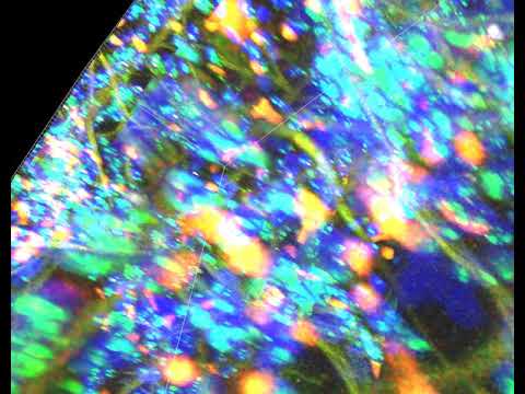 PLISH In situ hybridization of thick human lung tissue For SFTPC, MIR29-1, and AXIN2