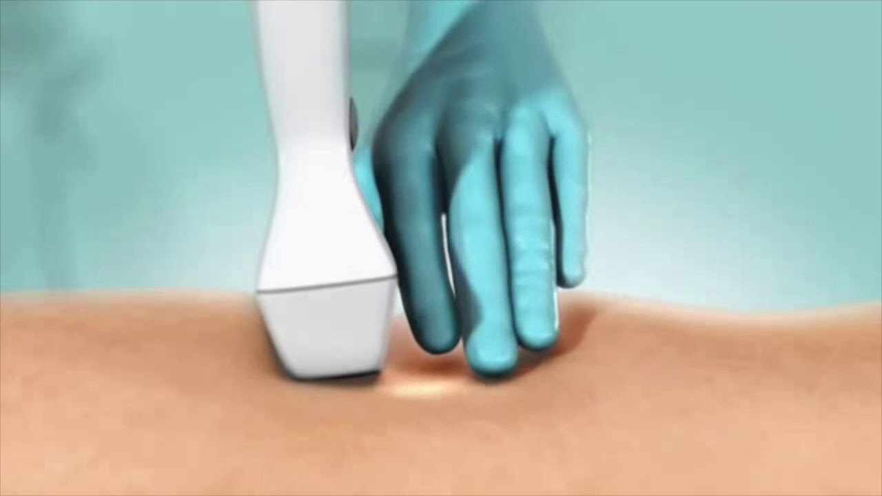 Marco Piercarlo Viani-6