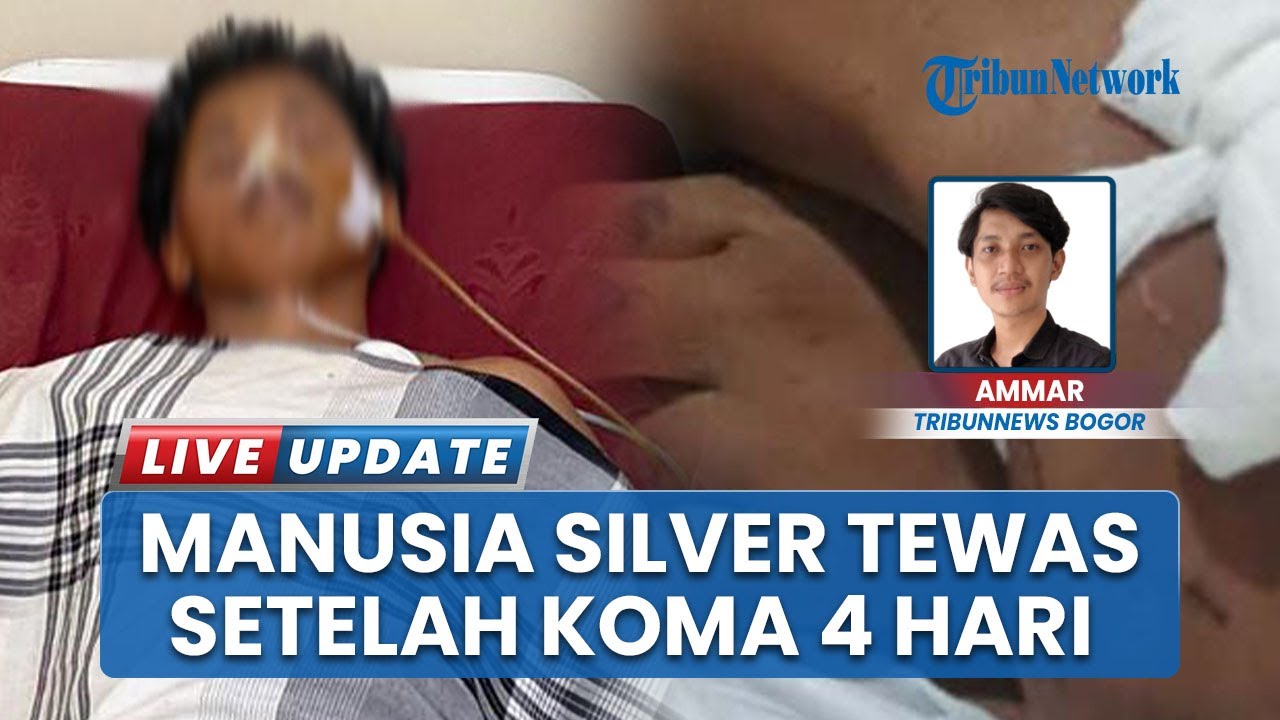 Koma 4 Hari seusai Konsumsi Obat-obat Terlarang, Manusia Silver Tanpa Identitas Tewas