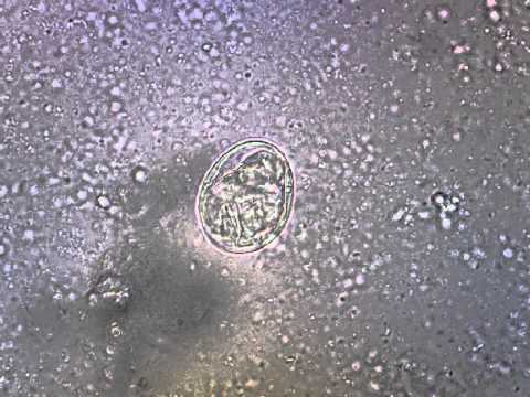 Fotografia di larve di helminths della persona Lentiggini e parassiti