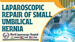 Laparoscopic Repair of Small Umbilical Hernia using Mishra's Knot and Dual Mesh