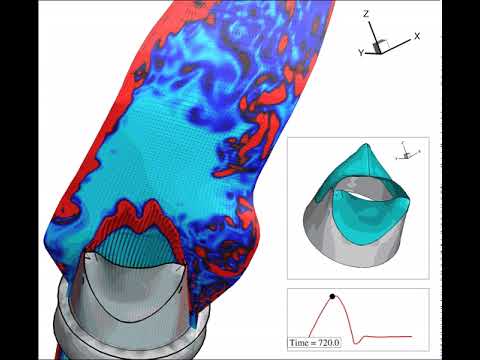 Bicuspid Aortic Valve FSI