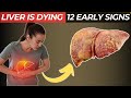 LIVER is DYING! 12 Weird Signs of Liver Damage | Pharmacykeystones
