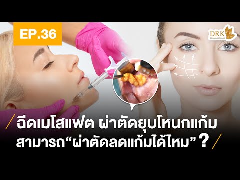 เมโสแฟตเหนียง