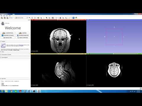 1.  3D Slicer - Introduction to 3D Slicer