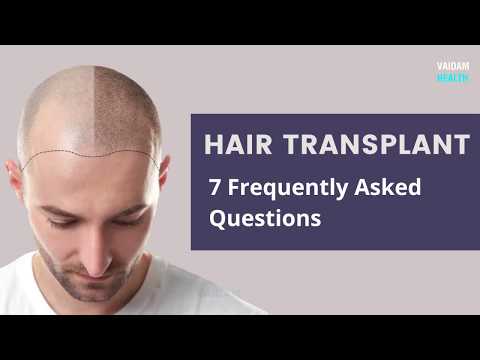 Hair Transplant - 7 Frequently Asked Questions