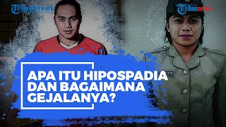 Apa Itu Hipospadia yang Dialami Aprilia Manganang? Begini Gejalanya