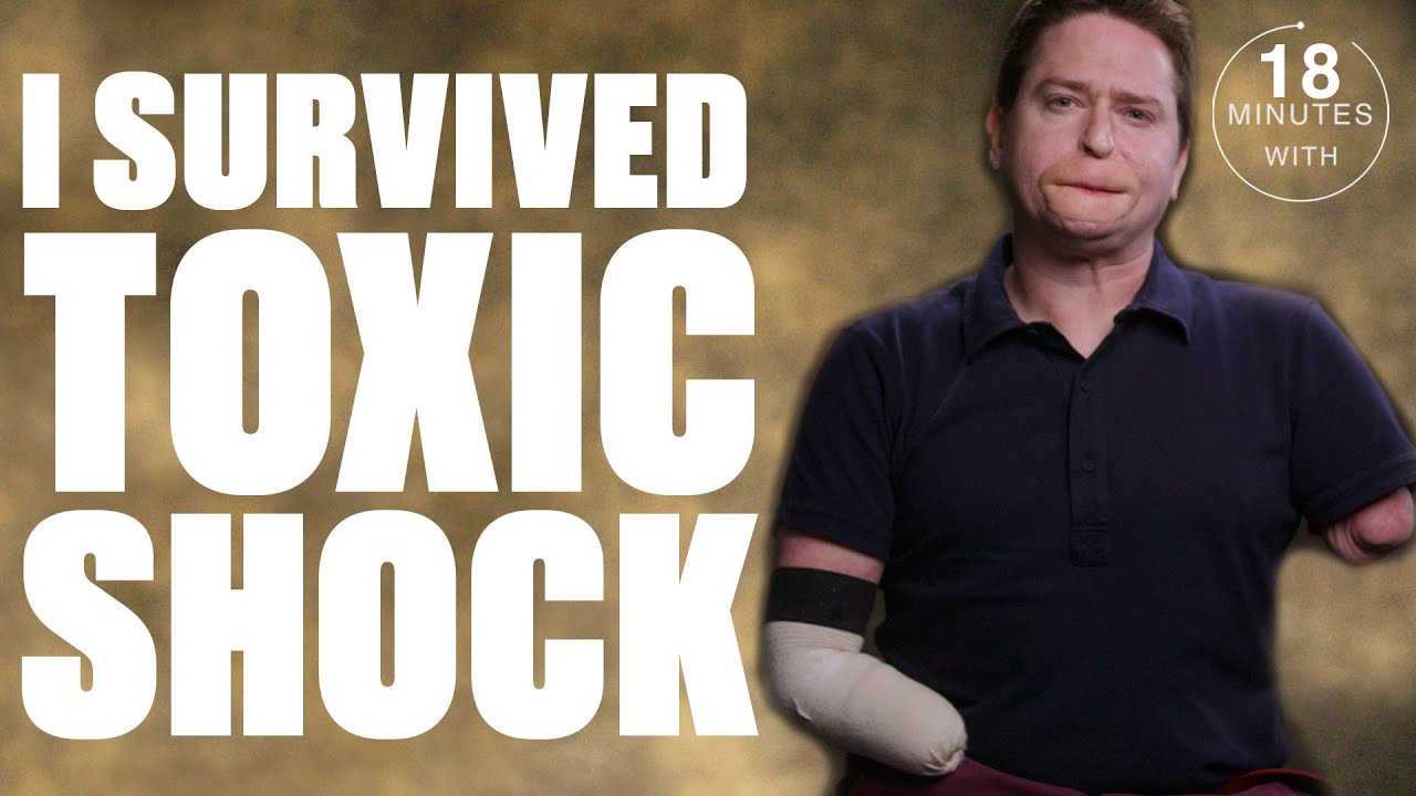 How I Lost All My Limbs | Minutes With | @ladbiblestories