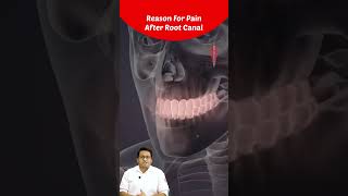 Top Reason For Pain After Root Canal Treatment | Dr Chirag Chamria | Royal Dental Clinics