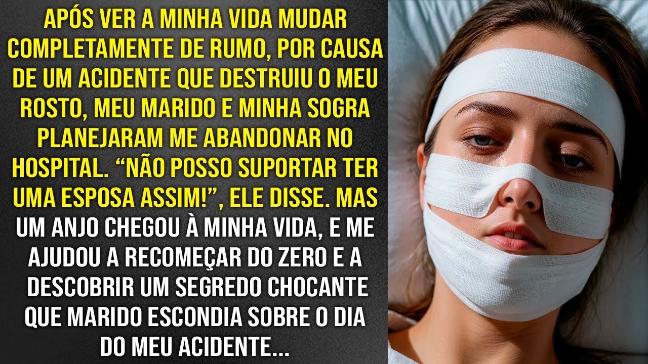 Após SOFRER um AC1DENTE que DEFORM0U o meu rosto, meu marido e SOGRA planejaram me abandonar  Porém