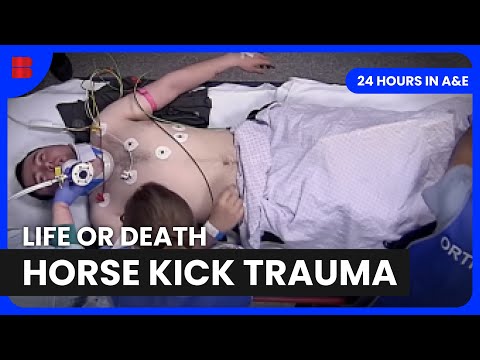 Horse Kick Trauma St Georges Emergency Department | 24 Hours in A&E