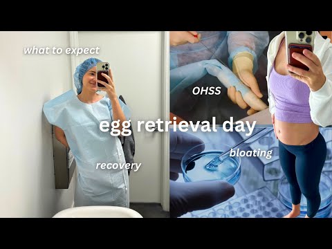 IVF EGG RETRIEVAL DAY | what to expect, extreme bloating, OHSS, recovery time, do's & dont's!